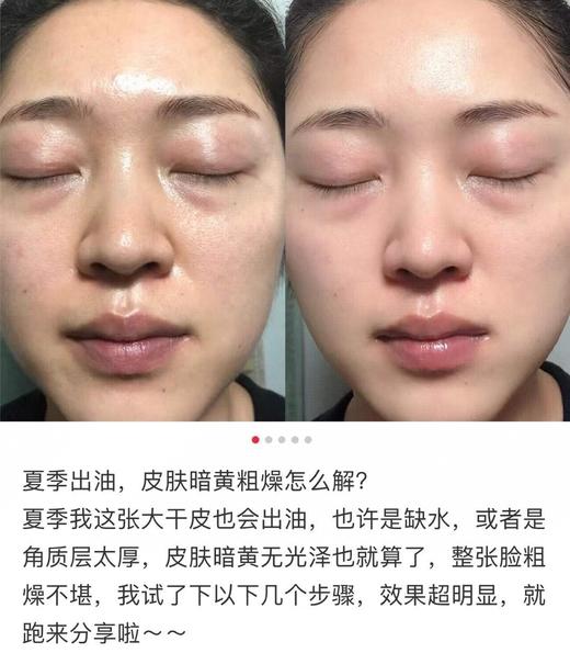 【限时折扣】超声波铲皮机（白色） 商品图3