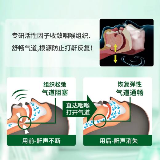 第2瓶立减20【轻松鼾立停，静享舒畅好眠】德国原装进囗，睡前一抹，缓解睡眠呼吸不畅！天然温和，通畅气道 商品图1