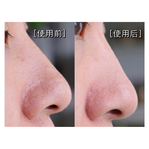 【限时折扣】超声波铲皮机（白色） 商品图2