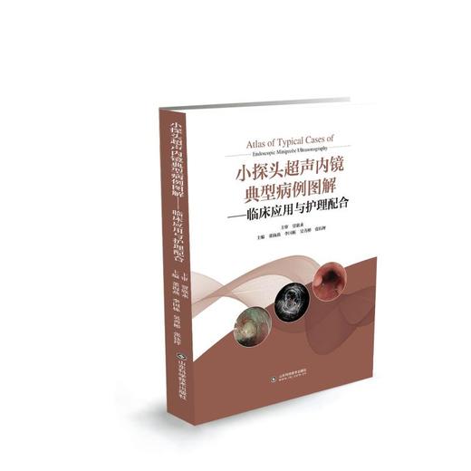 小探头超声内镜典型病例图解——临床应用与护理配合 商品图0