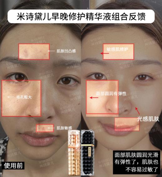 【抗衰精华】米诗黛儿6件护肤礼盒 商品图3