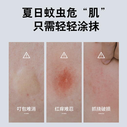 【蚊虫叮咬止痒神器5支装！】舒爽紫草膏 一抹舒爽  清凉止痒 拒绝蚊虫叮咬 多效修护香草膏 商品图2