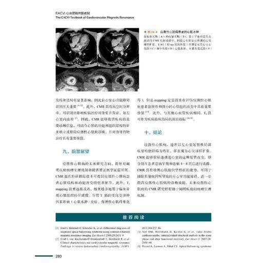 EACVI心血管磁共振教程 商品图1
