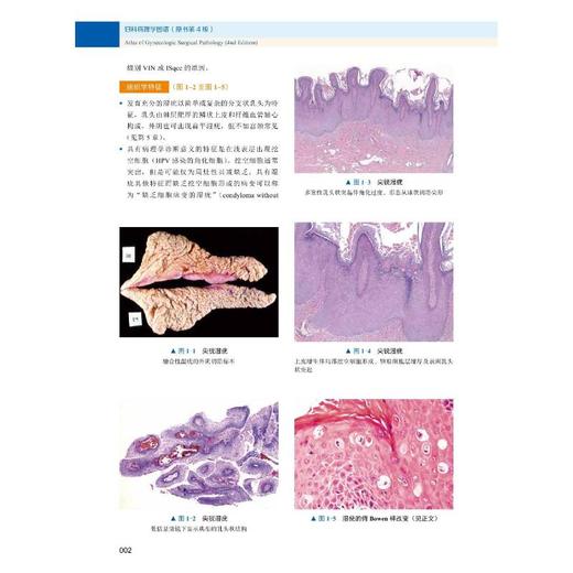 妇科病理学图谱 原书第4版 商品图1