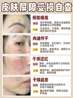 屏障受损自救指南！烂脸党都给我按头学！