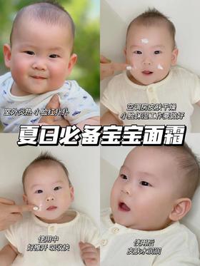 夏季人类幼崽必备面霜｜好用到无限回购❗