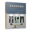 早发性脊柱畸形 主编 仉建国  协和出版 商品缩略图0