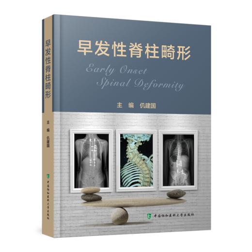 早发性脊柱畸形 主编 仉建国  协和出版 商品图0