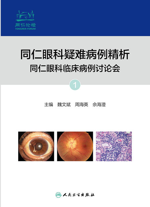 同仁眼科疑难病例精析：同仁眼科临床病例讨论会1 2022年7月参考书 9787117330305 商品图1