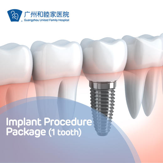 Implant Procedure Package (1 tooth)_DENT07 商品图0