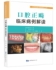 口腔正畸临床病例解读 商品缩略图0