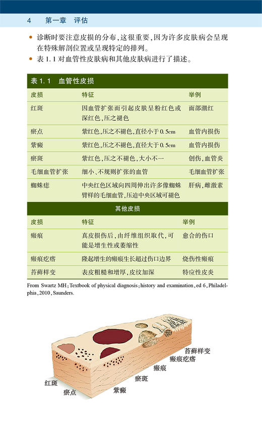 Ferri皮肤病实用速查 第2版 朱慧兰 郭庆 主译 皮损辨别部位皮疹特点症状鉴别常见皮肤疾病诊断 人民卫生出版社9787117331760 商品图4