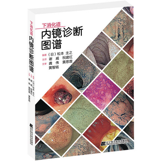 下消化道内镜诊断图谱 谢威 祝建红 译 消化道内镜操作注意事项中初级内镜医生参考书外科 辽宁科学技术出版社9787559123510 商品图1