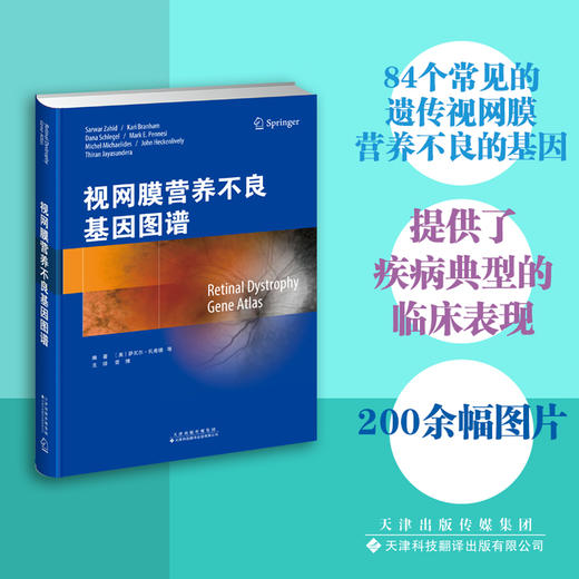 视网膜营养不良基因图谱 眼科 视网膜疾病 商品图0