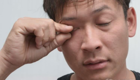 肾虚易导致水肿