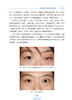 同仁眼科疑难病例精析 同仁眼科临床病例讨论会1 魏文斌 周海英 佘海澄 眼科学罕见病例疑难病例人民卫生出版社9787117330305 商品缩略图4