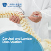 Cervical and Lumbar Disc Ablation 商品缩略图0