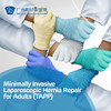 Minimally Invasive Laparoscopic Hernia Repair for Adults (TAPP) 商品缩略图0