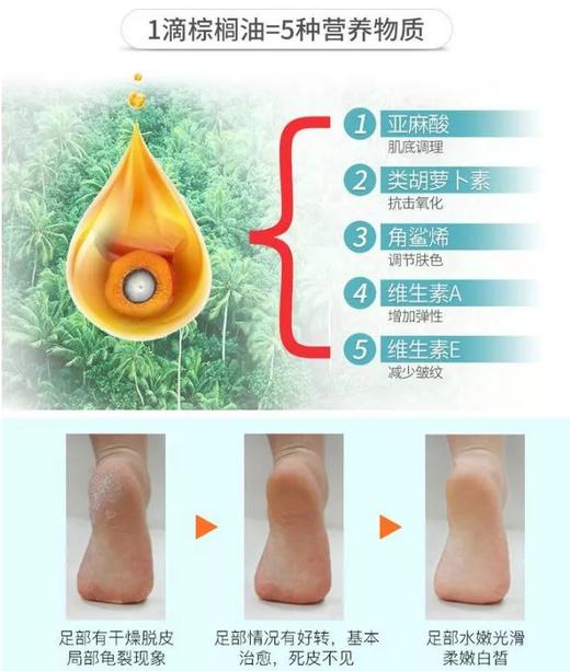 【清仓好价】韩国泉德拉足部清洁脚气皂70g *3 商品图2