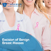 Excision of Benign Breast Masses 商品缩略图0
