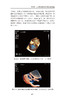 心血管疾病 诊断与鉴别诊断手册 孔小轶 南勇主编 心脏血管疾病诊疗 9787565925818北京大学医学出版社 商品缩略图4