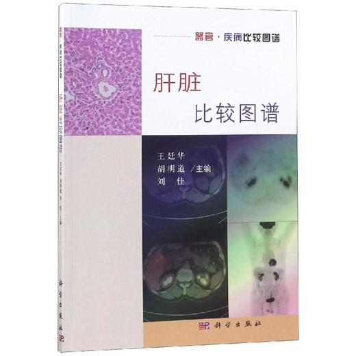 肝脏比较图谱 商品图0