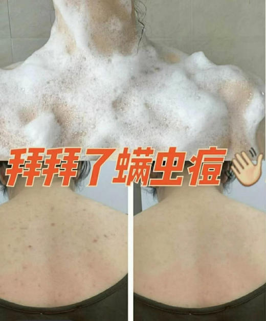 朴物大美果冻猫爪除螨皂90g去螨虫抑菌洗脸皂面部身体都可用 商品图14