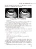 专科技能培训教程 医学影像与介入分册 专科医师规范化培训创新融合教材 廖伟华 周平 胡硕 编 人民卫生出版社9787117325943 商品缩略图4