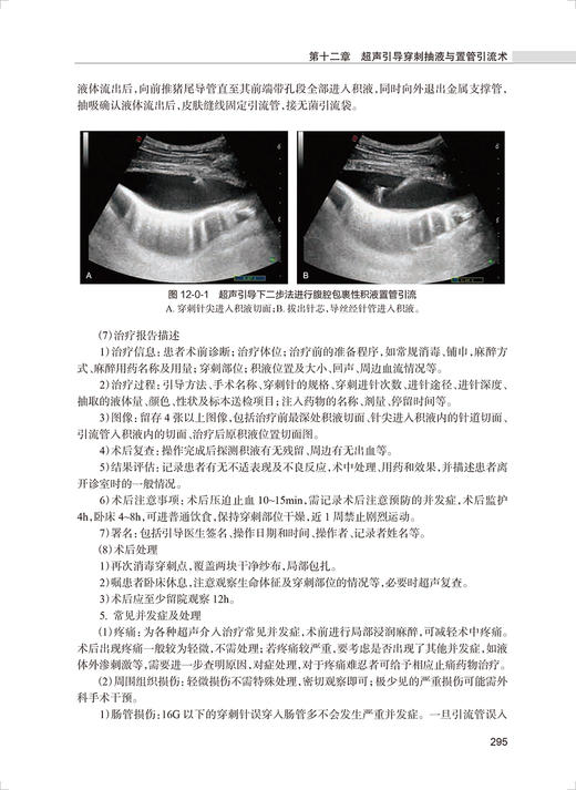 专科技能培训教程 医学影像与介入分册 专科医师规范化培训创新融合教材 廖伟华 周平 胡硕 编 人民卫生出版社9787117325943 商品图4