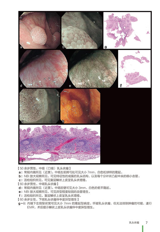 上消化道内镜诊断图谱 谢威 祝建红 译 消化道内镜操作注意事项中初级内镜医生参考书外科 辽宁科学技术出版社9787559123558 商品图3