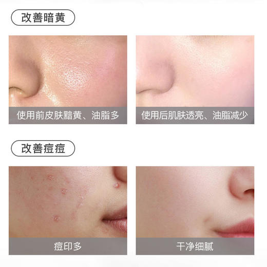 【美白净痘】伊芳妮RSH美白祛痘黑泥膜肌底透白技术修护舒缓冰淇淋质地易冲洗 商品图3
