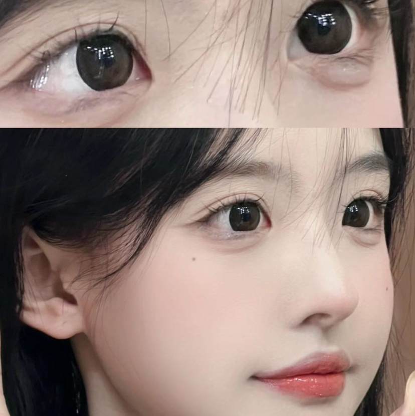 recolook嘟嘟黑（半年抛玻尿酸）