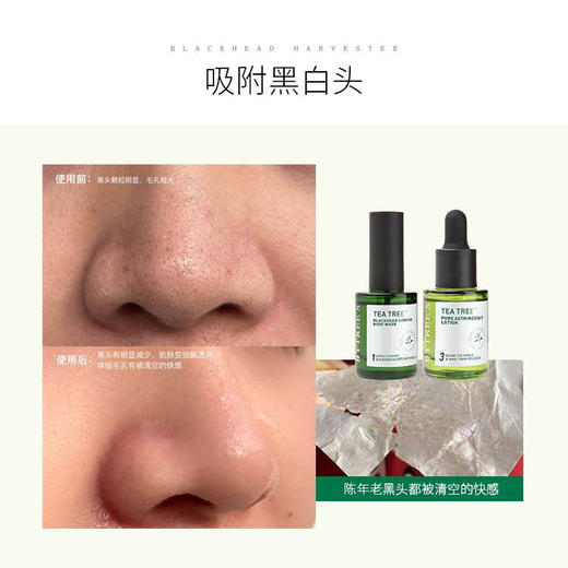 柏翠丝去黑头套装 商品图3