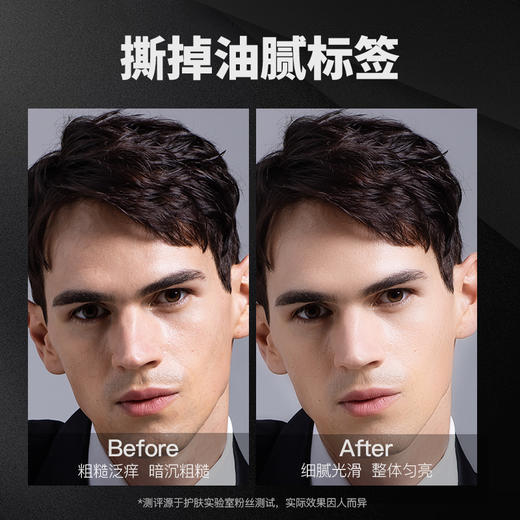 【男孩肌肤保养你得有一套 ，不做糙汉 】艾杜斯顿男士净肤控油套盒 水+乳+洁面 祛痘除螨保湿深层清洁男士护肤三件套 商品图3