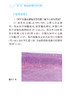 胃肠间质瘤诊治实用手册 叶颖江 秦叔逵 沈琳 胃肠间质瘤诊治的规范化诊疗和前沿进展问答形式 人民卫生出版社9787117331845 商品缩略图4