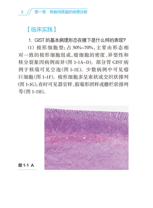 胃肠间质瘤诊治实用手册 叶颖江 秦叔逵 沈琳 胃肠间质瘤诊治的规范化诊疗和前沿进展问答形式 人民卫生出版社9787117331845 商品图4