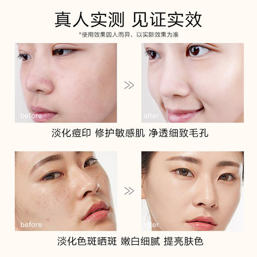 【至尊会员专享】瑜然美七子草本焕颜面膜泥美容院专用提亮肤色草本中药粉淡斑去黄 商品图3