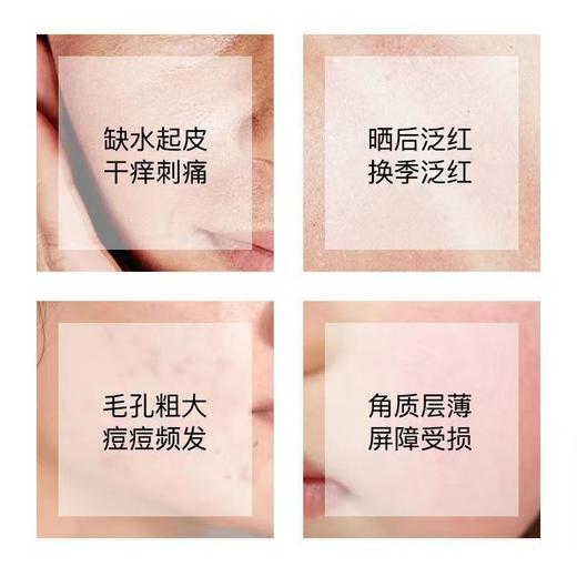 Acwell艾珂薇N4平衡调理保湿水乳套装 舒缓修护补水控油 商品图4