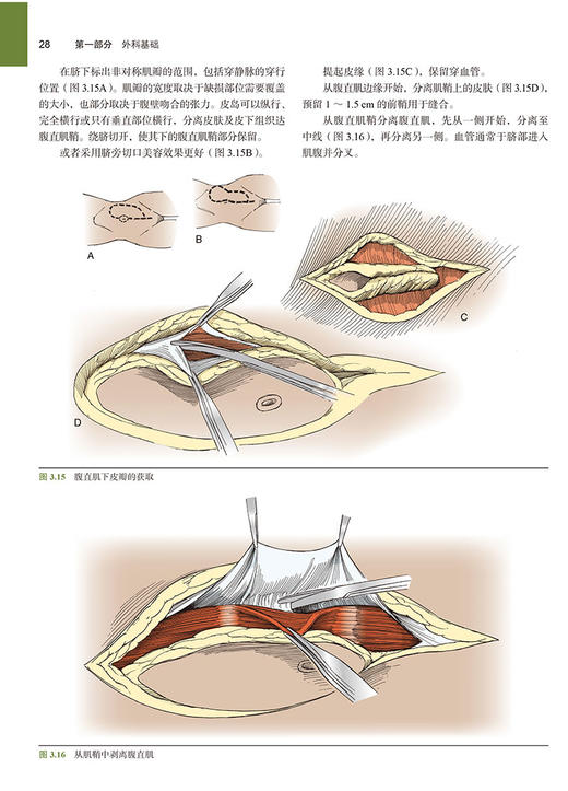 正版现货 辛曼泌尿外科手术图解 第4版 王东文 纪志刚 主译 泌尿外科手术环节操作方法手术入路 北京大学医学出版社9787565923586 商品图4