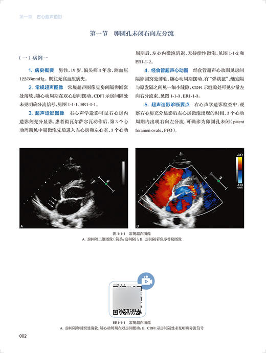 心血管超声造影图鉴 袁建军郭燕丽 中国医师协会超声医师分会超声造影图鉴丛书临床病例彩图视频人民卫生出版社9787117330459 商品图4