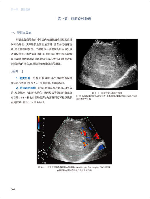 腹部超声造影图鉴 王辉 罗燕 编 中国医师协会超声医师分会超声造影图鉴丛书术后大体病例对照 人民卫生出版社9787117331005 商品图4