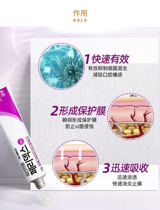 韩国peridex绿十字口腔溃疡膏！家中常备立竿见影！ 商品图3