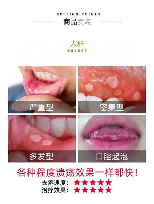 韩国peridex绿十字口腔溃疡膏！家中常备立竿见影！ 商品图4