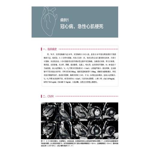 心血管磁共振 病例解析与临床实践 商品图4