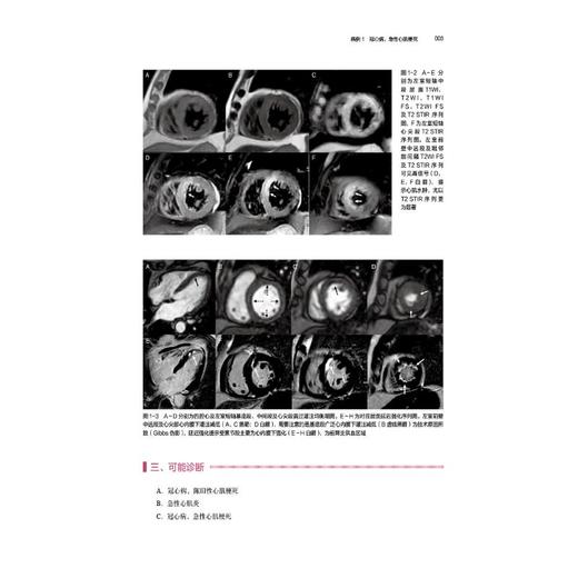 心血管磁共振 病例解析与临床实践 商品图1