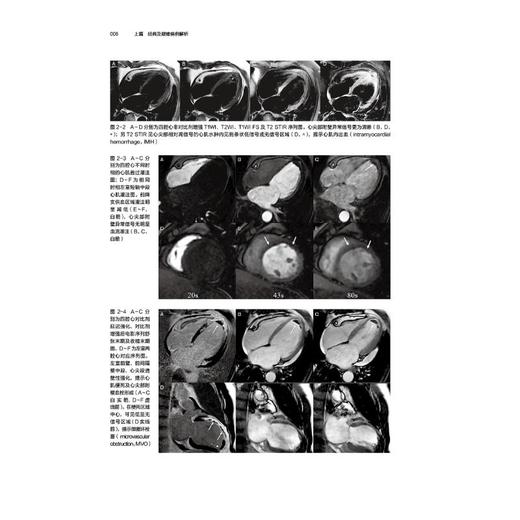 心血管磁共振 病例解析与临床实践 商品图2