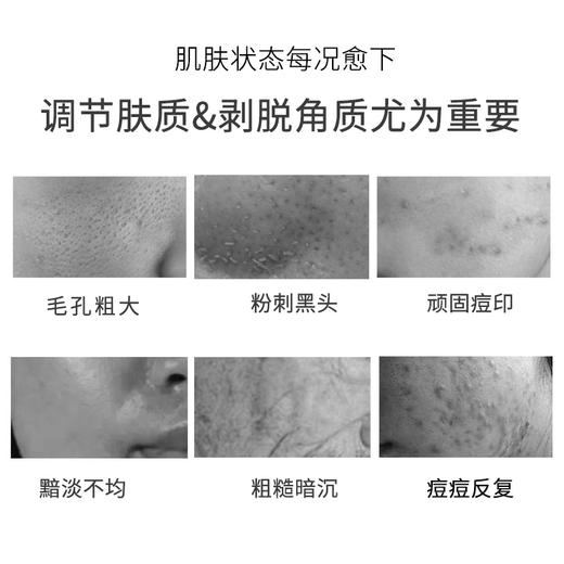 ZQ-II再启名门果酸焕肤精华液15ml 杏仁酸温和焕肤 商品图6