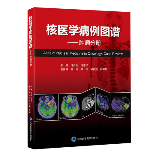 核医学病例图谱——肿瘤分册   付占立　何作祥 主编  北医社 商品图0