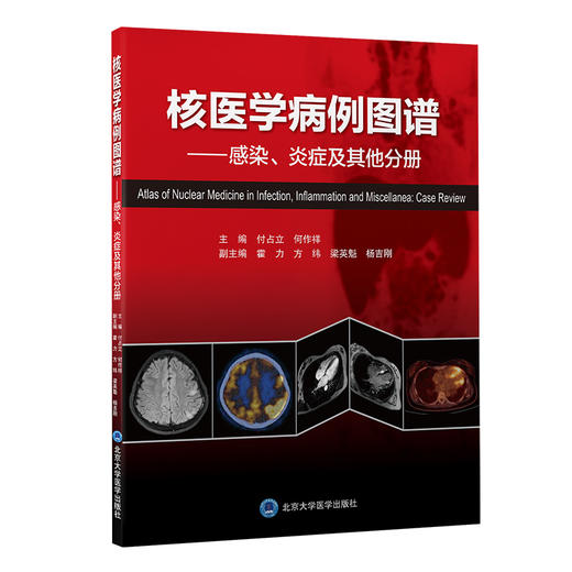 核医学病例图谱 ——感染 炎症 其他分册   付占立 何作祥 主编  北医社 商品图0