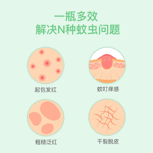 美国欧比信婴儿童驱蚊滚珠小绿珠走珠防蚊虫叮咬止痒消包1.5ml/瓶 商品图1